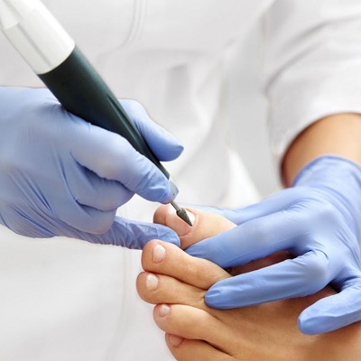 Medisch Pedicure